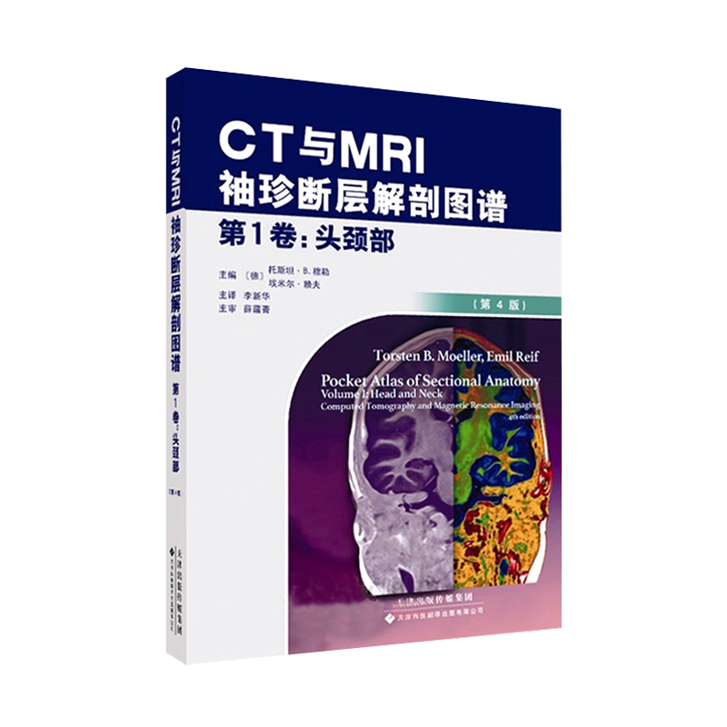 CT与MRI袖珍断层解剖图谱 头颈部 头颈部影像诊断学 头影测量 ct读片 医学影像 ct诊断与临床 天津科技翻译出版有限公司 - 图3