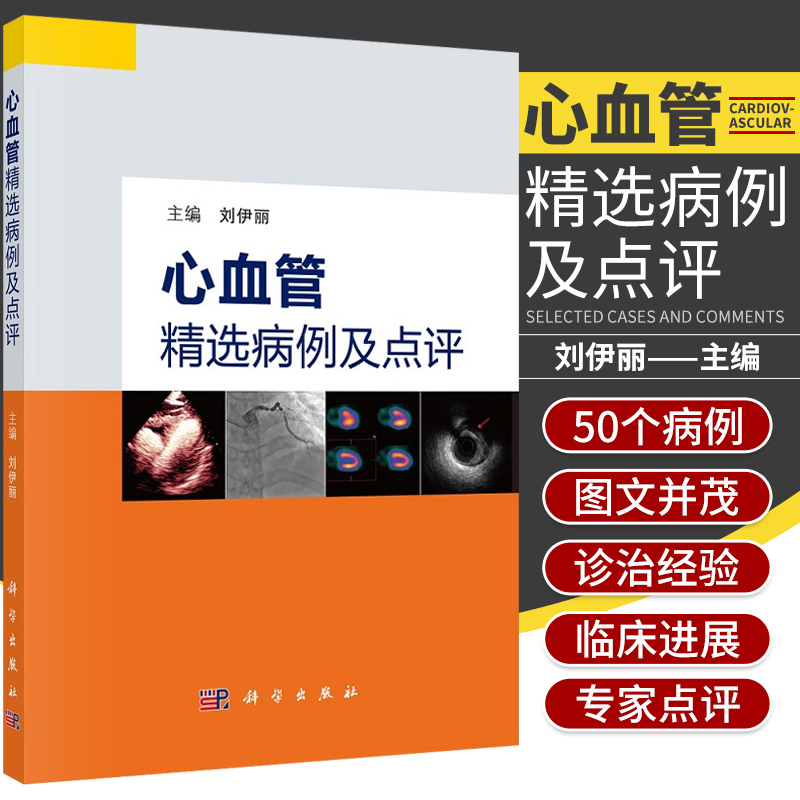 全2册心血管精选病例及点评第2二辑+心血管精选病例及点评科学出版社罕见的洋地黄毒性反应无冠状动脉阻塞的心肌梗死-图0