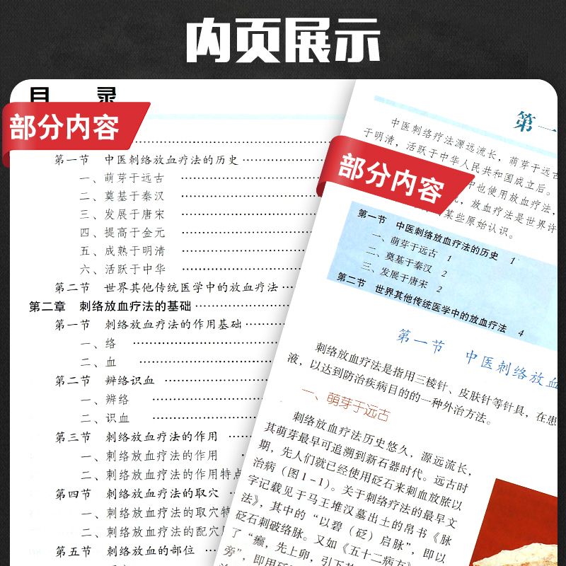 中医刺络放血疗法含光盘郭义书店图书医学中医学中医养生针灸试听教材中医学刺血疗法中国中医药出版社-图2