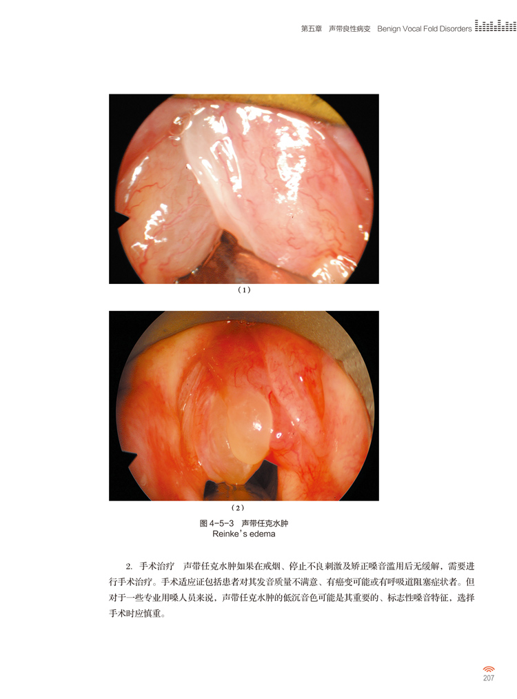 嗓音医学第2版版韩德民嗓音功能评估障碍诊断治疗技术发育器官声带咽喉发音方式基础人民卫生出版社-图3