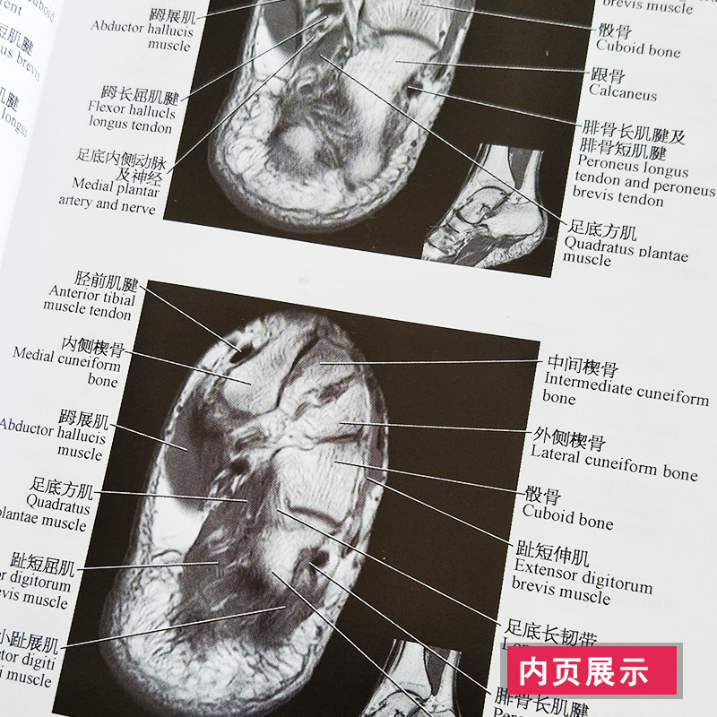 正版正常关节磁共振解剖图谱李明华上海科学技术出版社9787532397693正版书籍-图2