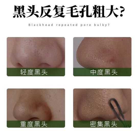 AOPY-Kit de esencia para espinillas, oligopéptido, limpieza de Zona T, cuidado de espinillas, exportación de espinillas, esencia líquida para el cuidado del parche de nariz