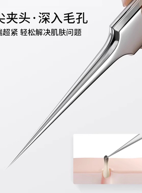 超细细胞夹挤痘痘清理工具