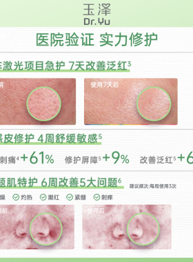 屈臣氏玉泽积雪草安心修护面膜(650mg+25ml)×10片 官方正品