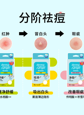 屈臣氏护妍天使净瑕痘痘贴30贴加赠12贴轻薄隔离防水透气温和去痕