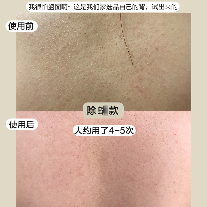 很灵！ 季德胜艾草驱蚊止痒蚊虫叮咬喷雾除螨祛痘去痱健肤水喷剂 - 图0