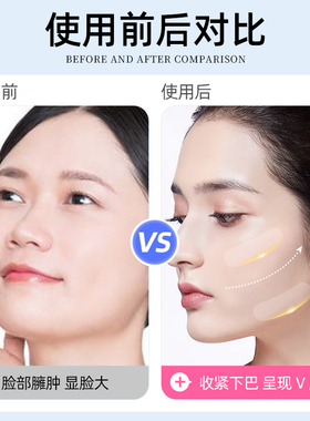 面部提拉小脸贴隐形透明胶带