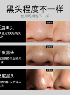 男士鼻贴BOSSDUN．MEN/波斯顿