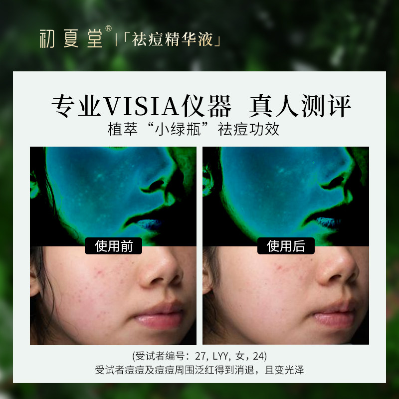初夏堂小绿灯祛痘面部舒缓精华液 初夏堂液态精华