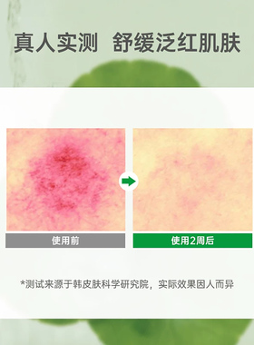 wellage唯拉珠玻尿酸保湿面霜抗皱滋润干燥敏感肌积雪草舒缓修复