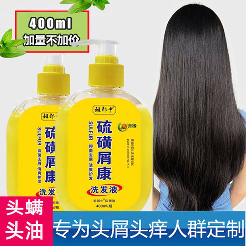 硫磺洗发水洗头膏升级头螨头屑头痒脂溢性头皮屑控油毛囊硫磺软膏 - 图0
