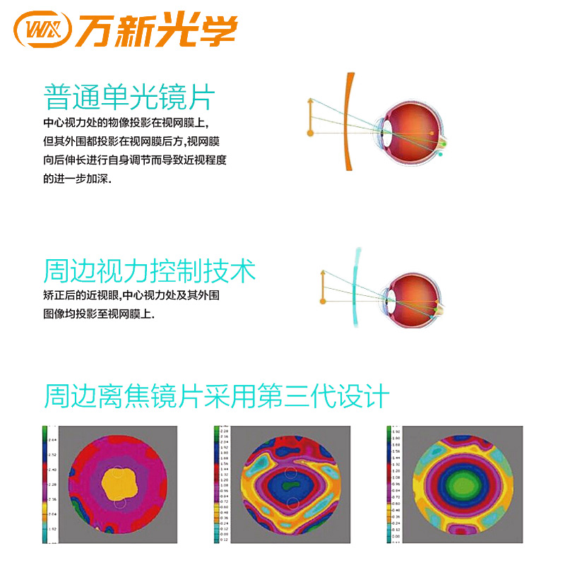 大视野眼镜专营店万新 乐轻松 1.56周边离焦近视眼镜片1.61全焦环焦防控儿童眼镜片0
