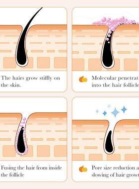 Permanent Hair Removal Cream Chest Back Leg beard Painless膏