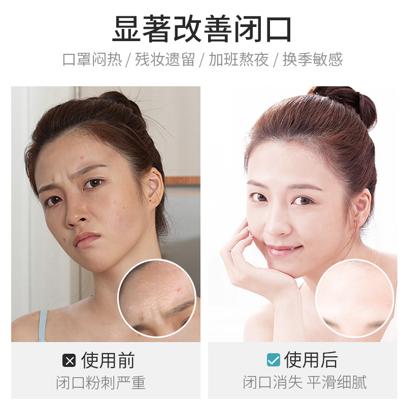 欧丽源旗舰店欧丽源马迷纯露去闭口粉刺收毛孔 马鞭草酮迷迭香爽肤水0