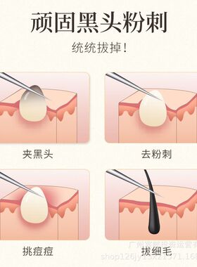 镊子一次性超细针痘痘粉刺纳葆蓓