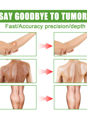 Fatty Lumps Cream Unclogging Body Multiple Fatty Lumps Tumou