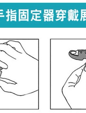 弯曲固定器肌腱断裂护托锤状指