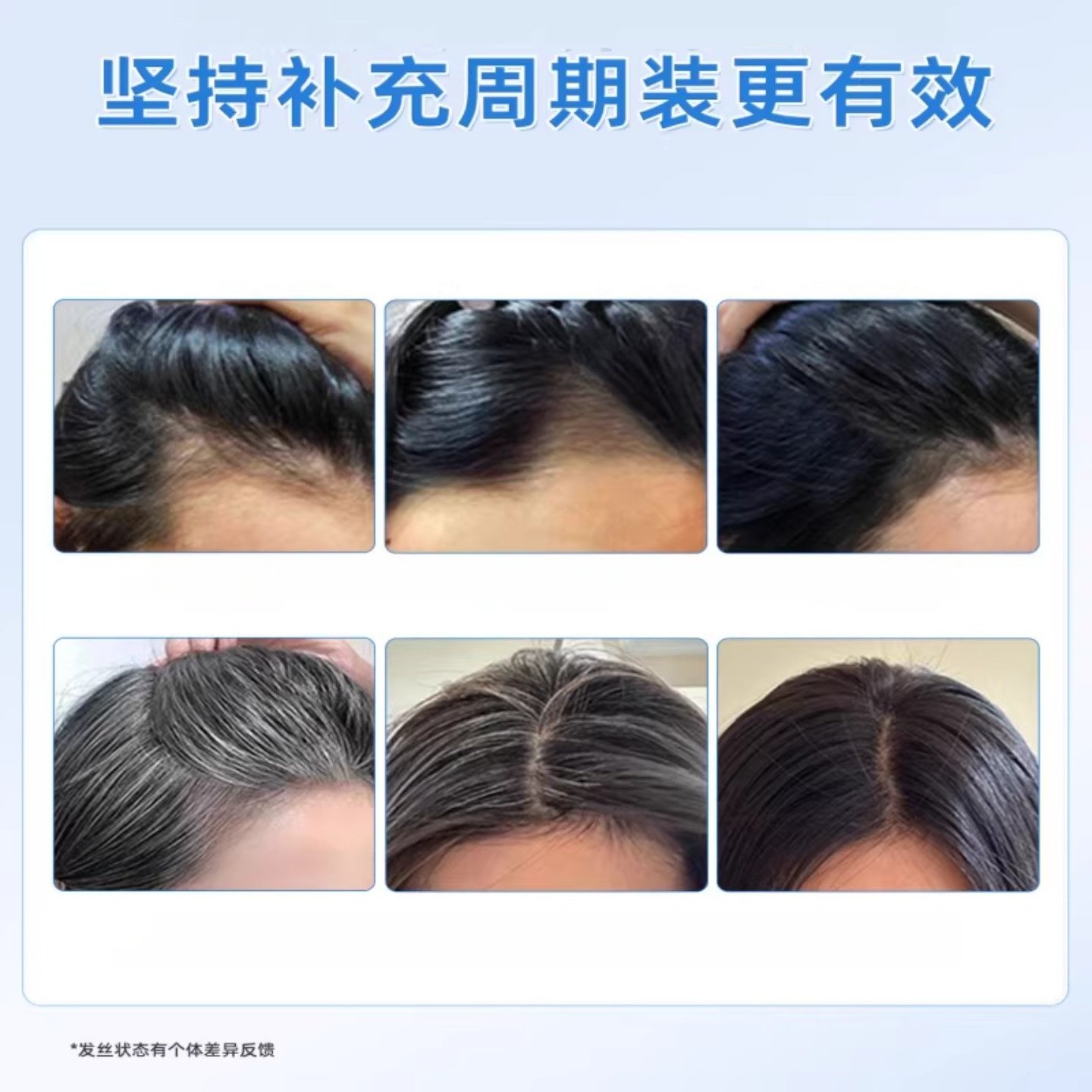 安贝复合维生素B族乌发素白发脱发缇生物素黑发养发草本提取正品,淘宝优惠券,粉丝福利购,淘宝优惠卷