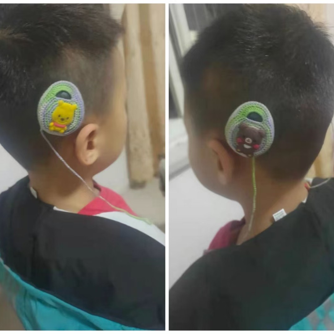 奥地利一体机RONDO1RONDO2澳大利亚一体机Kanso1Kanso2人工耳蜗套 - 图1