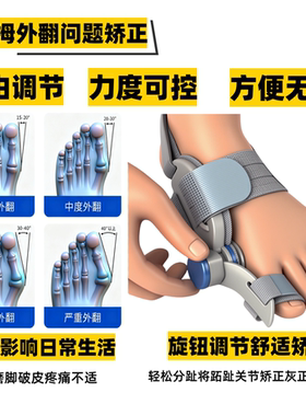 旋钮调节大拇指外翻矫正器
