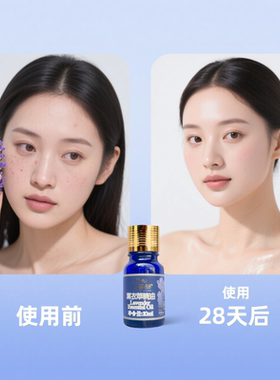芙罗兰薰衣草控油补水嫩肤精油
