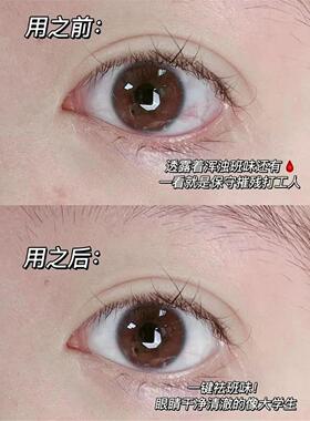 满3盒包邮   蓝莓叶黄素眼睛喷雾眼周护理缓解眼部疲劳