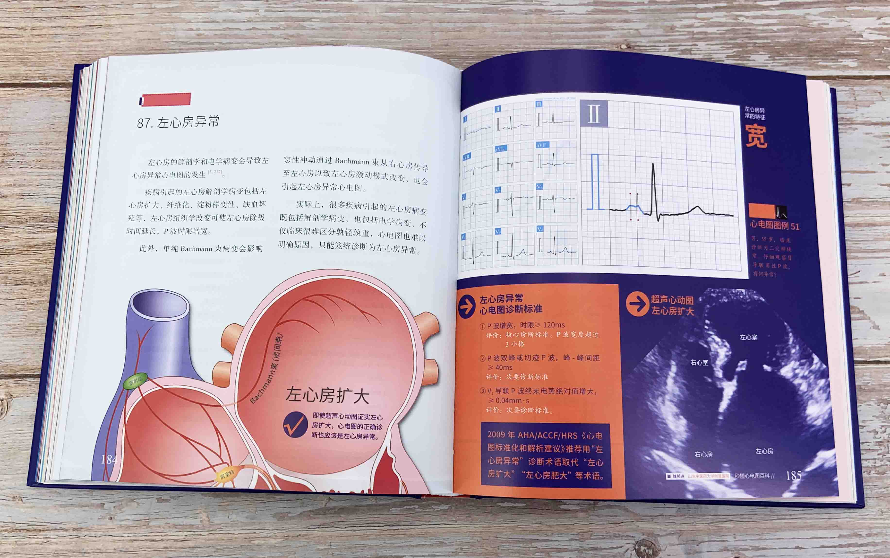 秒懂心电图百科 魏希进 心电图从入门到精通 心电图形成原理概念 正常心电图分析 心律失常患者或家属参考 对心电图感兴趣读者参考 - 图0