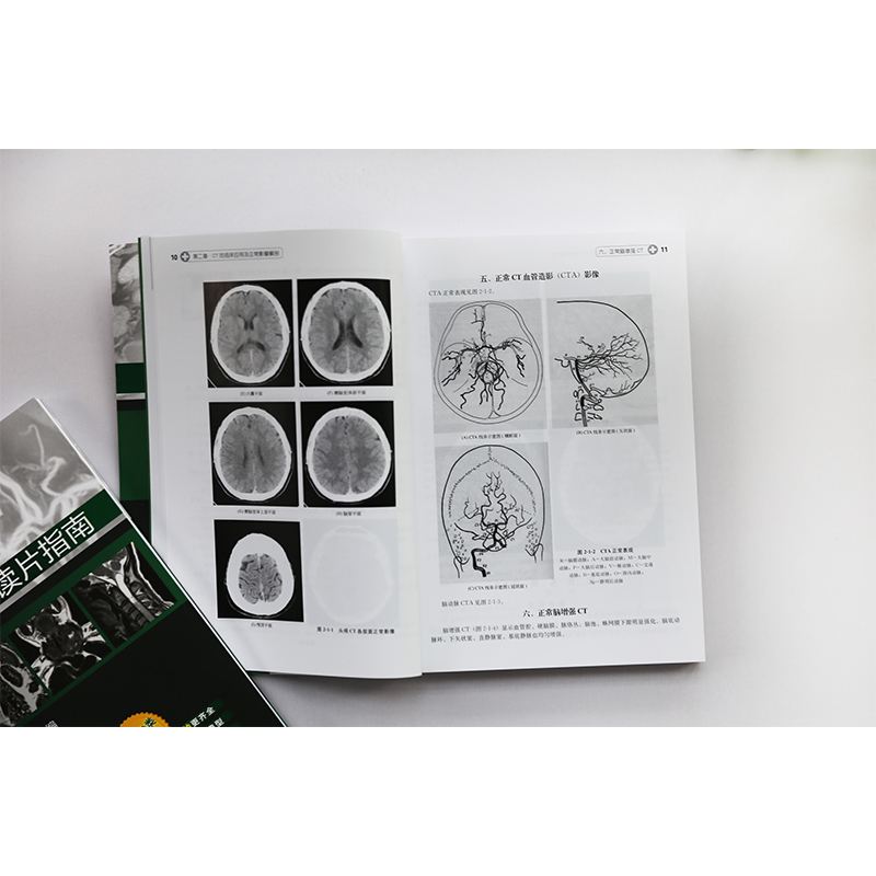 正版 影像读片从入门到精通系列 CT读片指南 第二版 医学药学医学影像CT诊断影像临床诊断 基层影像医师影像科新手实用参考书 - 图2