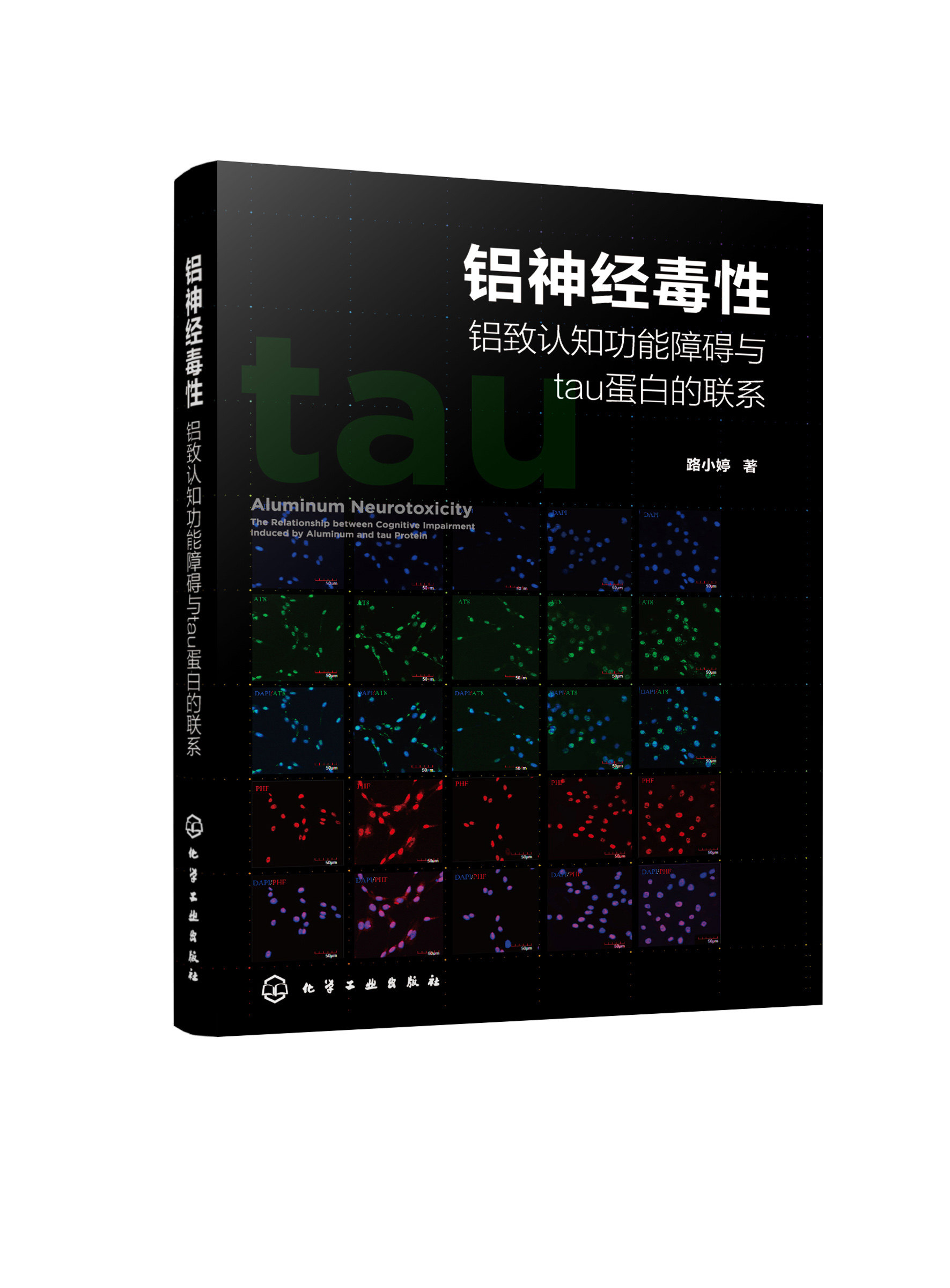 铝神经毒性铝致认知功能障碍与tau蛋白的联系 铝神经毒性研究书籍 老年性疾病预防书籍 轻度认知功能障碍 阿尔茨海默病 老年型痴呆