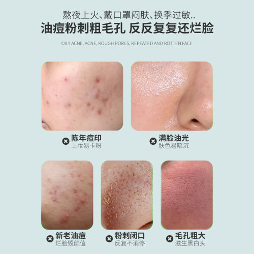 冰王痘克清痘凝露20祛痘印淡化痘印去痘克可合用抑菌凝胶乳膏正品 - 图1