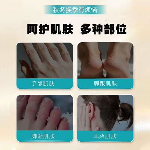 冰王冬宝蛇油膏手足耳朵正品可与防冻防裂止痒冻疮膏合用旗舰店 - 图0