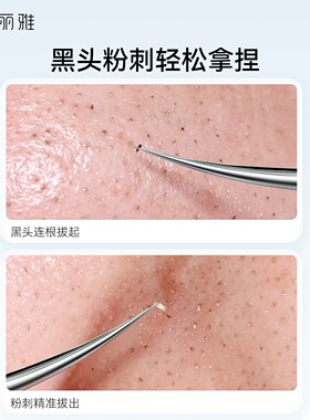 妮丽雅细胞夹粉刺针去黑头美容院清洁工具海豚夹镊子高精密黑头夹