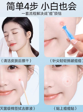 海氏海诺无菌一次性粉刺针黑头闭口痘痘去脂肪粒暗疮针辐照灭菌