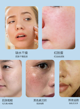 婉蓉嫣玻尿酸面膜贴补水保湿透明质酸免洗靓颜面膜（一片）
