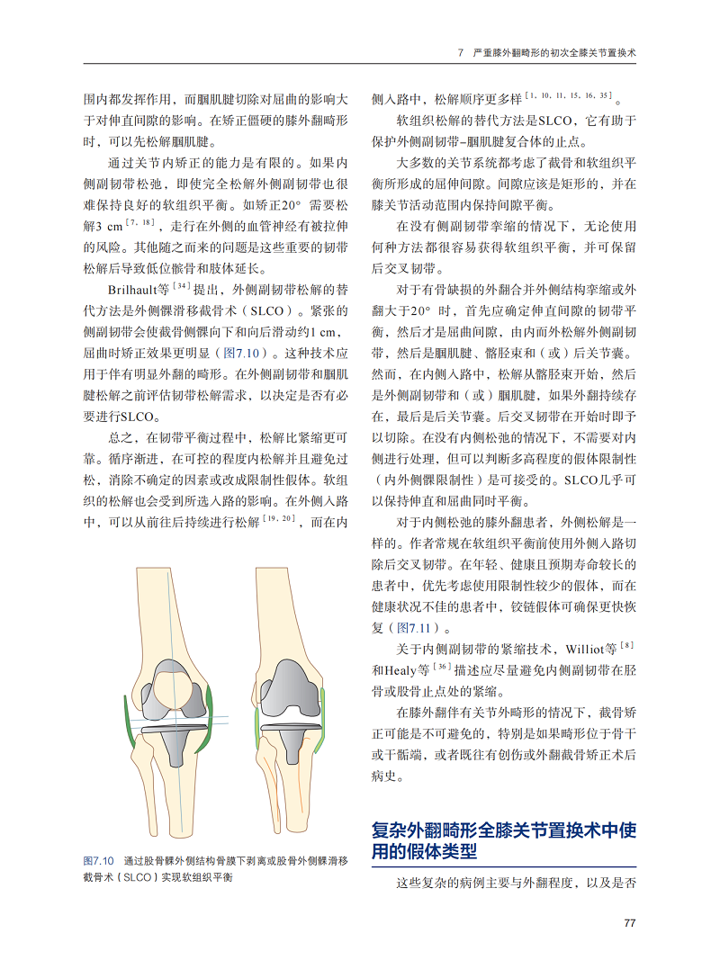 复杂初次全膝关节置换术 S. K.S.Marya主编 山东科学技术出版社 适合外科医生及医学生阅读 膝关节畸形的复杂性外翻内翻固定屈曲 - 图0