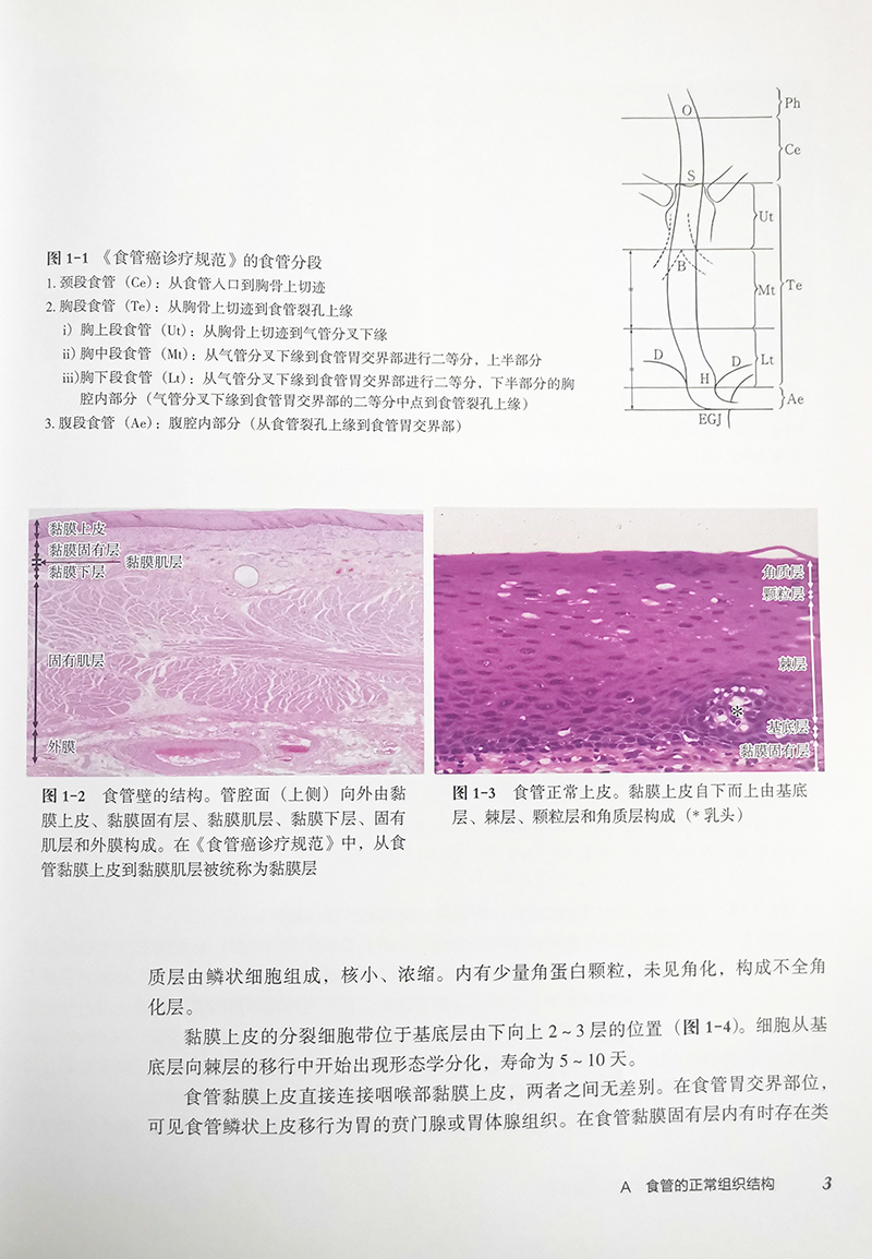 消化道病理及活检诊断图谱 中村恭一 等著 消化系统疾病活体组织检查 影像诊断图谱胃食管疾病 辽宁科学技术出版社9787559123503 - 图2