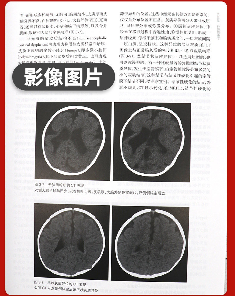 两本套装儿童神经病学 第3版+诸福棠实用儿科学第9版 全两册 全国各级医院儿科医师的案头经典 常见疾病诊疗 常见症状的鉴别诊断