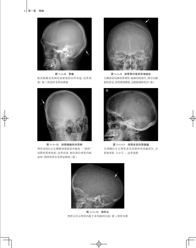 现货新版颅脑与头颈部影像图解正常解剖常见变异常见病变汪文胜胡春红影像解剖与临床图解临床医学丛书影像实用书籍人民卫生出版社 - 图2