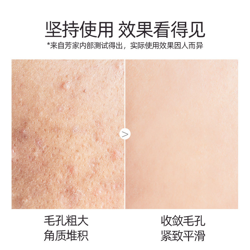 乳糖酸面部护理水乳护肤套装果酸 芳丹薄罗面部护理套装