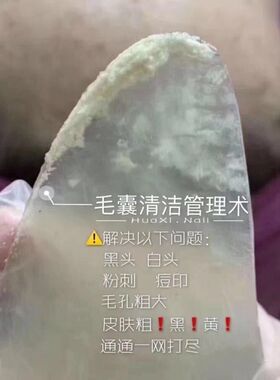 毛囊净化霜美容院专用祛粉刺