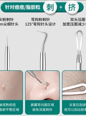 粉刺针细胞夹美容针黑头夹5号痘痘针【赠消毒棉片+放大镜】