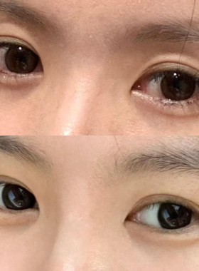 意大利Mycli眼霜拯救上眼皮耷拉
