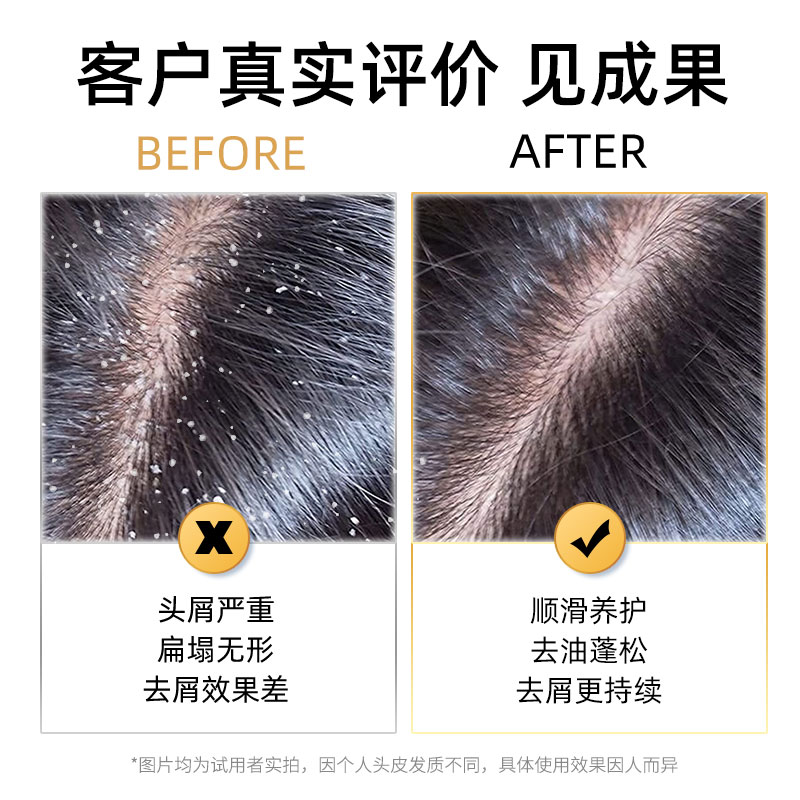 采乐洗发水控油清洁去屑止头痒清爽蓬松去油留香男女士正品去头屑 - 图2