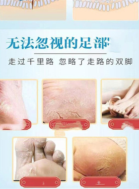足部舒缓滋润手足改善手足