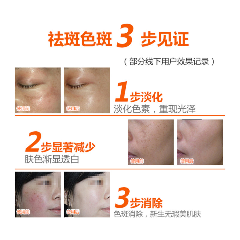 白大夫鑫品美白去老年斑保湿祛斑霜 白大夫品牌店乳液/面霜