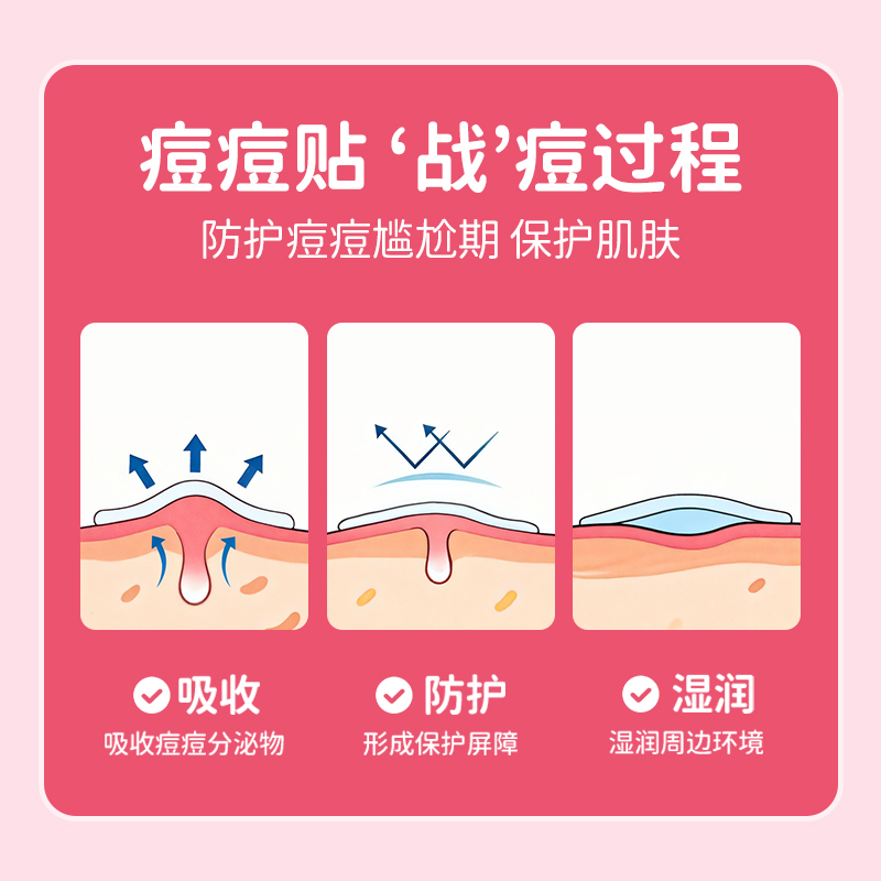 蓝帆医疗星星痘痘贴医用可爱卡通水胶体敷料净痘创口贴皮豆豆贴 - 图3