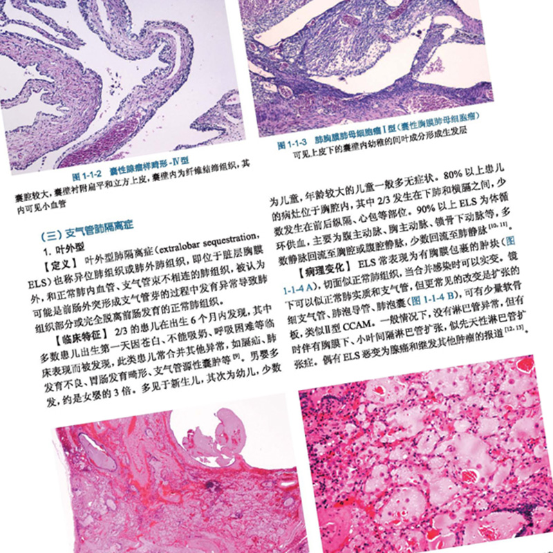 临床病理诊断与鉴别诊断 气管 肺 胸膜及纵隔疾病 王恩华 张杰主编 人民卫生出版社9787117266451 - 图2