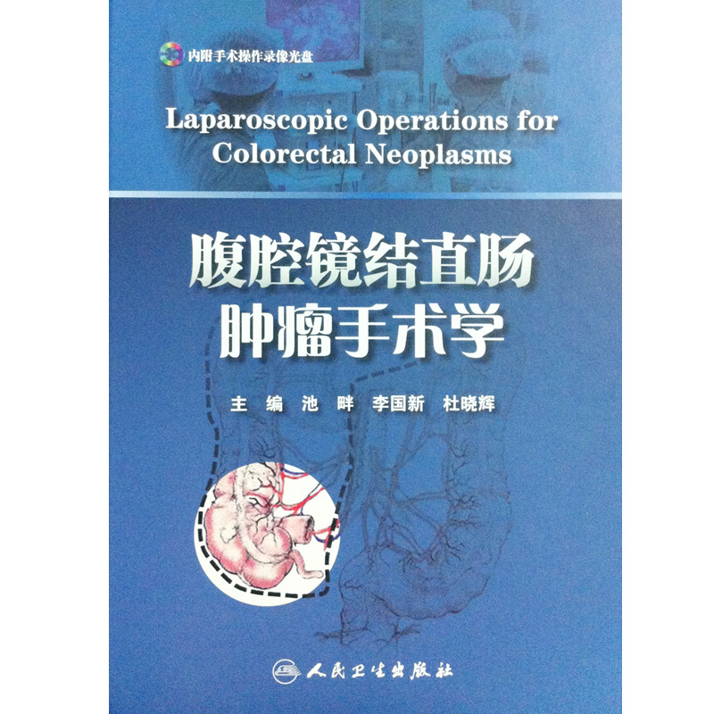 腹腔镜结直肠肿瘤手术学  池畔 李国新 杜晓辉主编 人民卫生出版社 结肠癌的CME手术 直肠癌经腹柱状切除 机器人辅助下的直肠癌术 - 图3