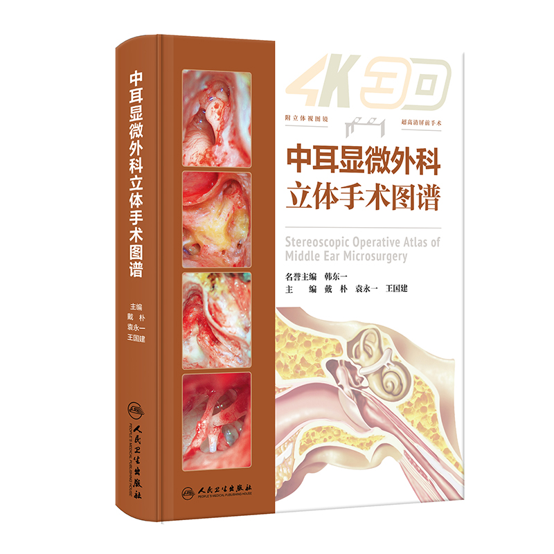 中耳显微外科立体手术图谱 中耳乳突常见病的显微外科手术 眩晕外科 镫骨外科 面神经外科 人工耳蜗植入人民卫生出版9787117355957 - 图0