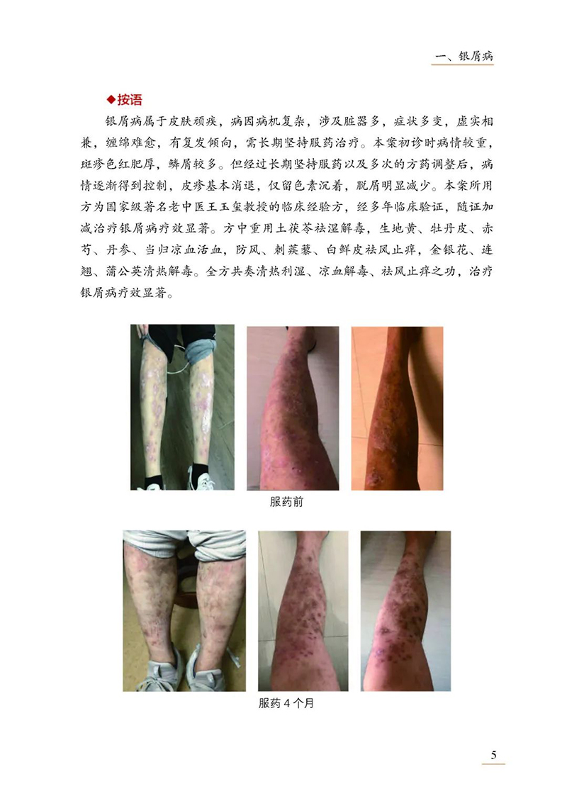 王学军皮肤病医案选 王学军 张雅丽 王放 临床常见病种经典案例中医诊疗思路 辨证论治经方应用调治 中医古籍出版社9787515227016